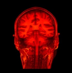 Simon Tegala WHATEVER HAPPENED TO EVERYTHING YOU BELIEVE IN 2007 MRI animation Duration: 1min, 19sec