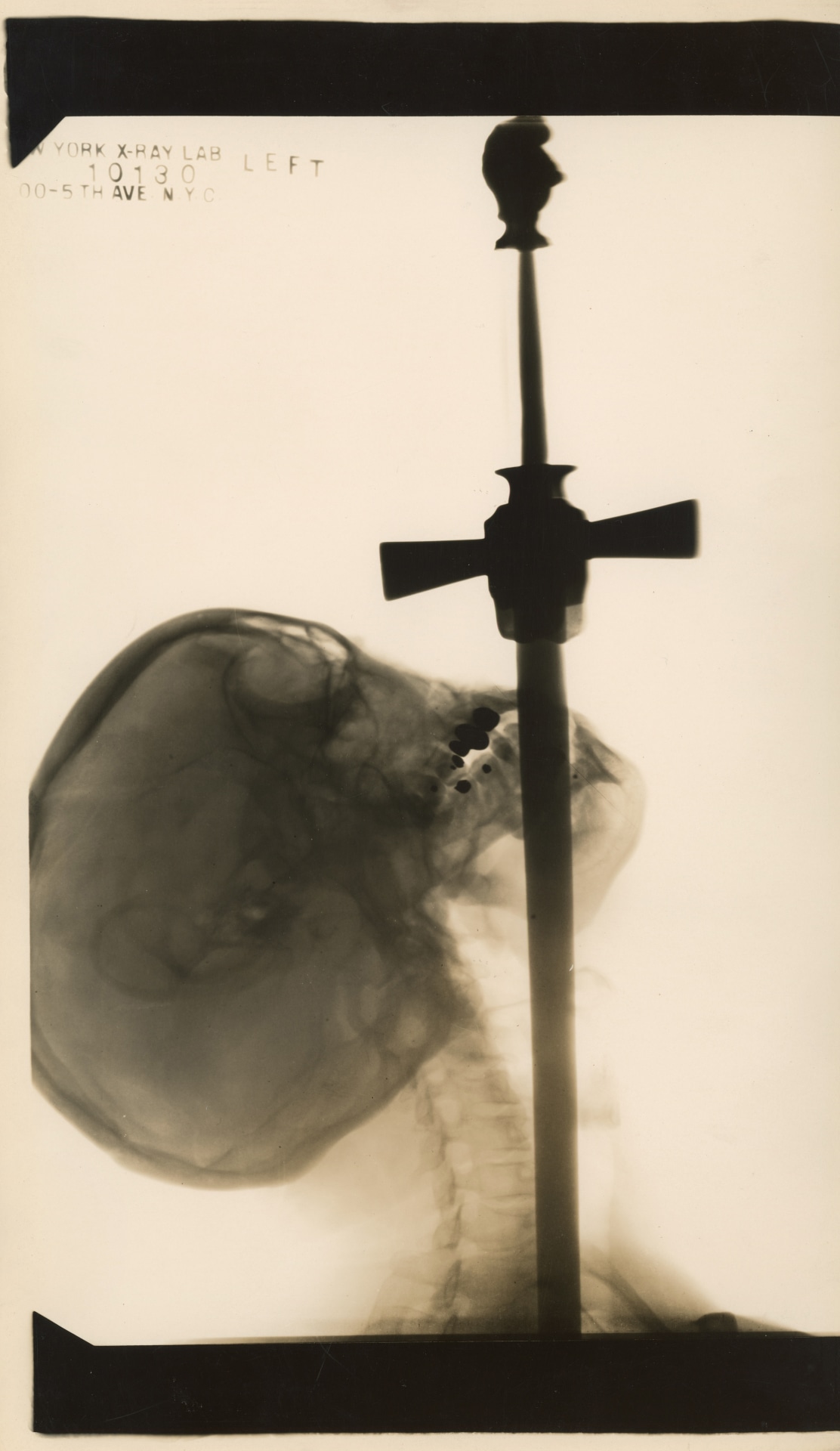 EDWARD KELTY - X-RAY OF AJAX &ldquo;THE SWORD SWALLOWER&rdquo;, 1928, DREAM-LAND CIRCUS SIDE-SHOW, CONEY ISLAND