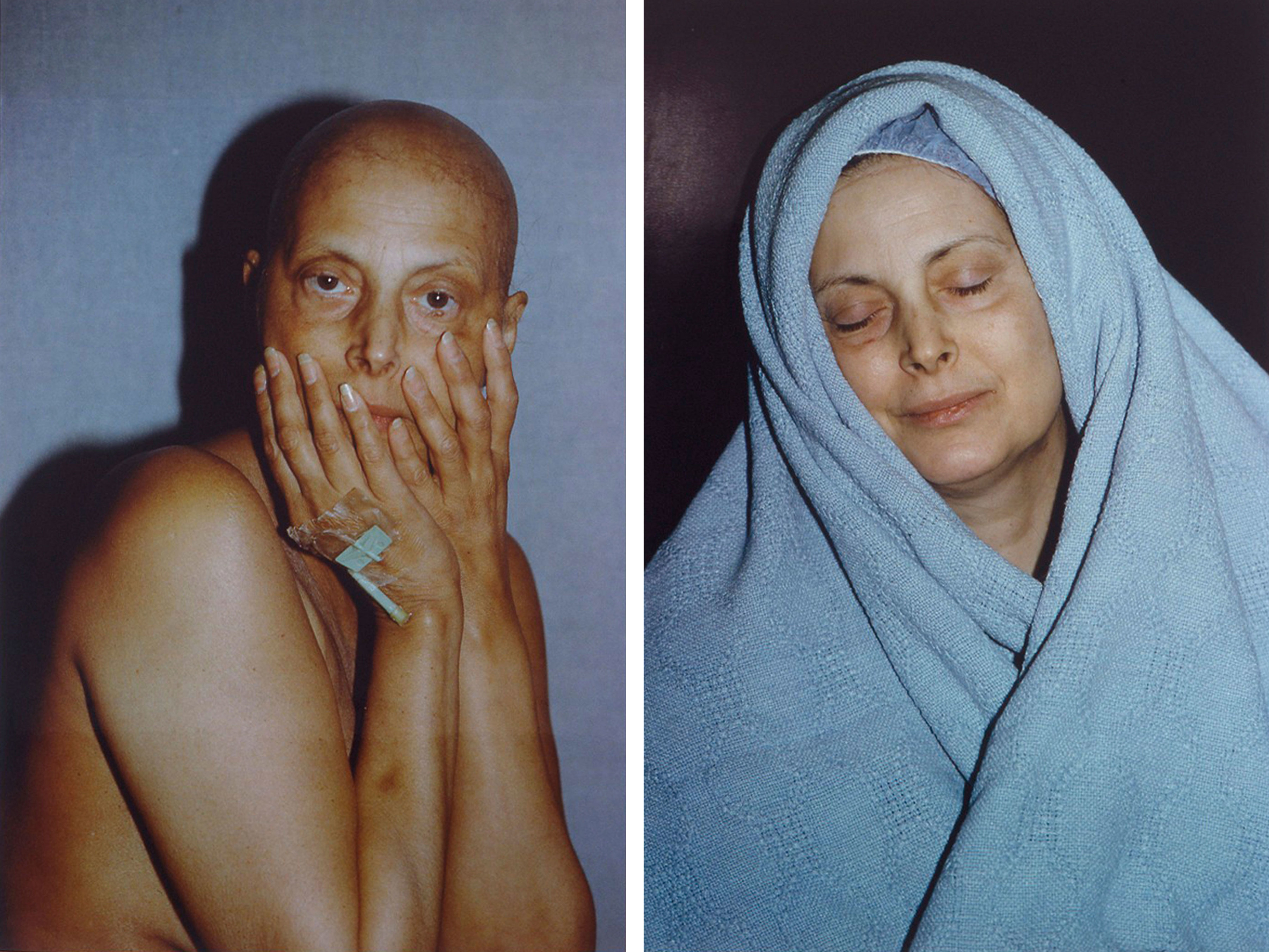 Hannah Wilke
Intra-Venus Series No. 4, July 26 and February 19, 1992, 1992
Two Chromogenic supergloss prints
Each photograph: 71 1/2 &amp;times; 47 1/2 inches (181.6 &amp;times; 120.7 cm)
Performalist Self-Portraits with Donald Goddard
Hannah Wilke Collection &amp;amp; Archive, Los Angeles.
Courtesy Alison Jacques, London.
&amp;copy; Donald Goddard. Courtesy Donald and Helen Goddard and Ronald Feldman Gallery, New York.
