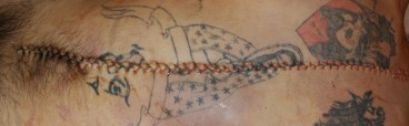 Crisscrossing stiches on tattooed human remains