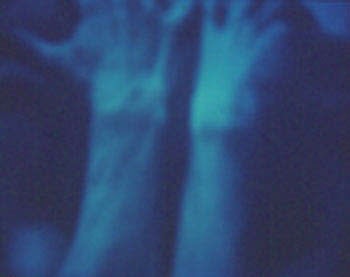 Reverie No. 22, 2001