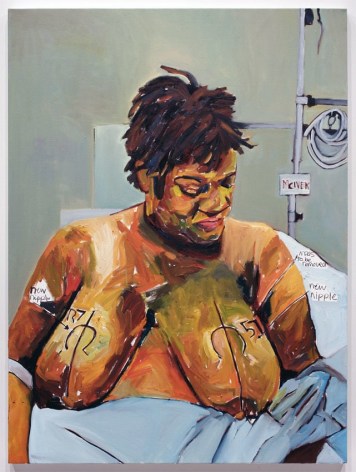 Pre-Breast Surgery, 2013, Oil on Canvas