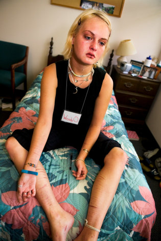 Wendy, 20, In her Room with Self-Inflicted Cuts, Coconut Creek Florida, 2005, Archival Pigment Print