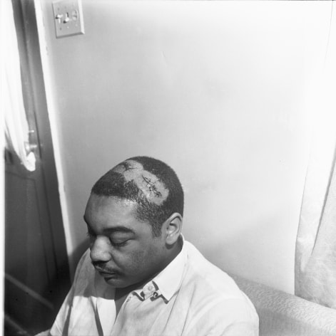 Morris Webb, beaten almost unconscious by officers, just after noon at a restaurant several blocks west of the Clayborn Temple, 1968, Archival Pigment Print