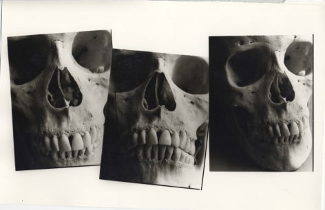 Skull Three Times, 1986, Silver Gelatin Photograph