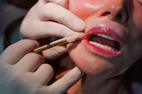 Jackie Goldberg, 72, also known as &ldquo;The Pink Lady&rdquo;, gets collagen injections as part of her preparation for the Ms. Senior California beauty pageant, Beverly Hills, California, 2006, Combined Edition of 25
