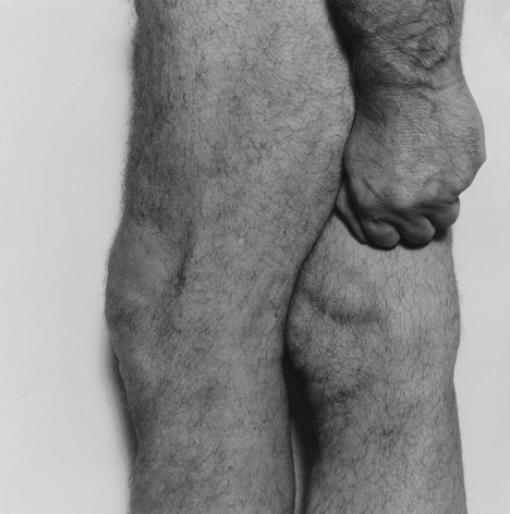 Side View, Knees with Fist, 1984