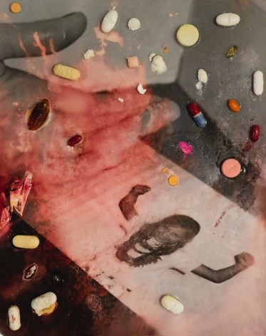 Meghann Stelzner, Resilience