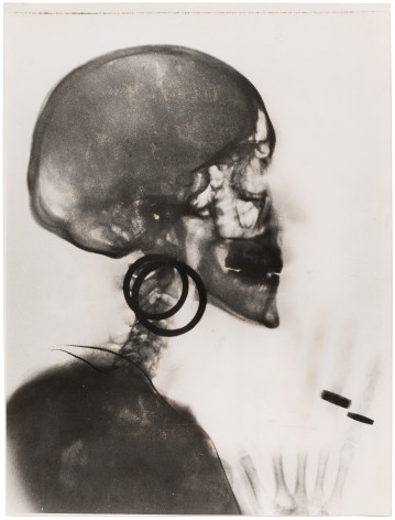 Meret Oppenheim (1913-1985), Röntgenaufnahme des Schädels M.O. / X-Ray of M. O.&rsquo;s Skull 1964