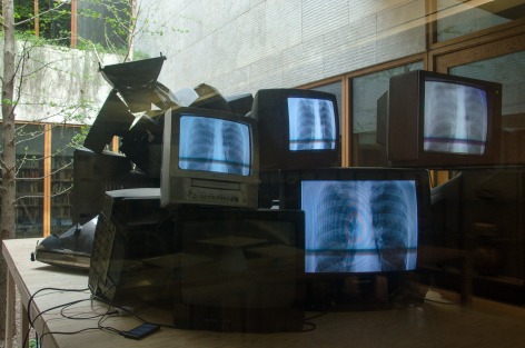 WILMER WILSON IV  a long pane beat in  2017, cords, cellphones, CRT televisions with X-ray photograph, dimensions variable. Installation view: The Barnes Foundation