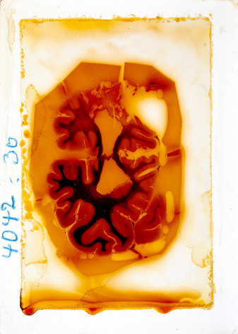 JON MALIS Brain 4042, Slide 30 2011, digital pigment print, 7 x 5 inches
