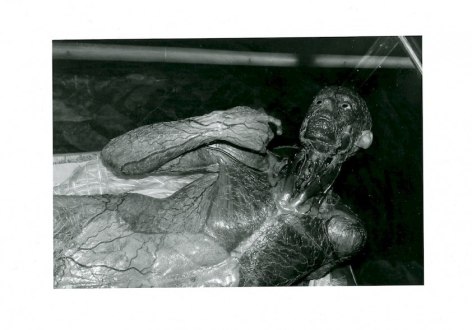 A black and white photograph of a body used for medical studies, depicting the entire nervous system. The form seems to be laying down, with their elbow bent toward their face.