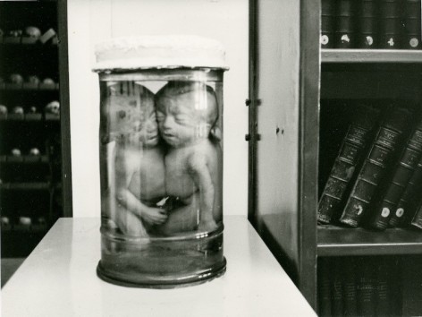 A black and white photograph of conjoined twins in a receptacle, situated on a white shelf. On the right side in the background we see shelves of books; on the left are abstract samples and items.
