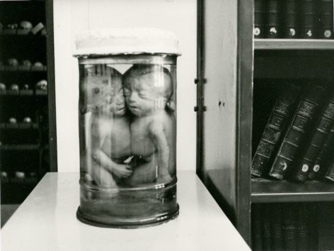 A black-and-white photograph of two fetuses preserved in a jar, sitting on a table in a library