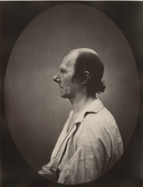 DUCHENNE DE BOULOGNE and Adrien TOURNACHON (French, 1806-1875 &amp; 1825-1903) Portrait of the old man in profile*, 1862, negative, circa 1856 Albumen print from a glass negative 22.1 x 16.5 cm oval on 22.8 x 17.5 cm paper, mounted on 41.0 x 27.3 cm paper