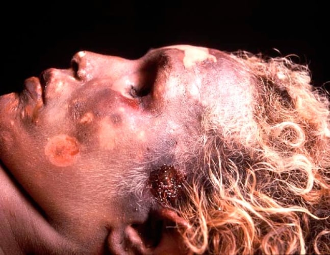 Andres Serrano &quot;The Morgue (Jane Doe Killed by Police)&quot; 1992 Cibachrome, silicone, plexi-glass, wood frame 49 1/2&quot; x 60&quot;