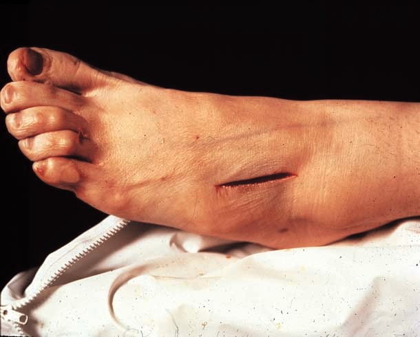 Andres Serrano &quot;The Morgue (Rat Poison Suicide II)&quot; 1992 Cibachrome, silicone, plexi-glass, wood frame 49 1/2&quot; x 60&quot;