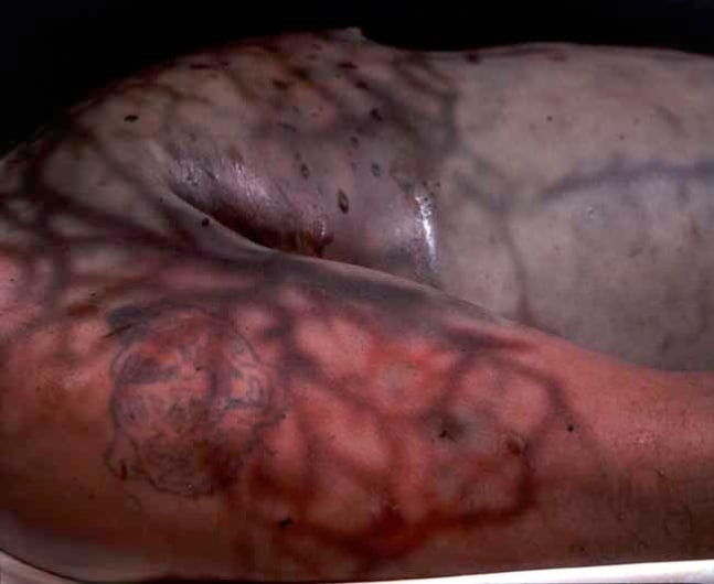 Andres Serrano &quot;The Morgue (Death by Drowining III)&quot; 1992 Cibachrome, silicone, plexi-glass, wood frame 49 1/2&quot; x 60&quot;