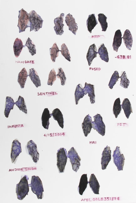 City Black – In My Lungs, 2014
Ink and watercolor pencil on paper
10.25” x 7.13”