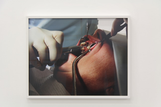 Installation view of photographs by Torbjørn Rødland