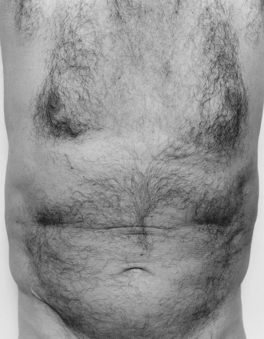 Torso, Front, 1984