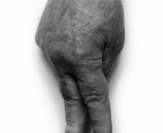 Fingers Standing, II, 1999