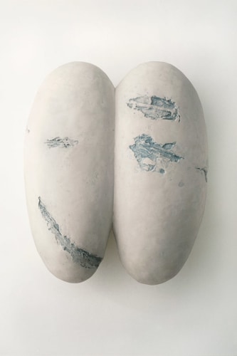 Mary Ann Unger, Mitosis Series No. 2 