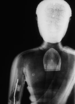 An x-ray photograph of the statue of Ratnasambhava