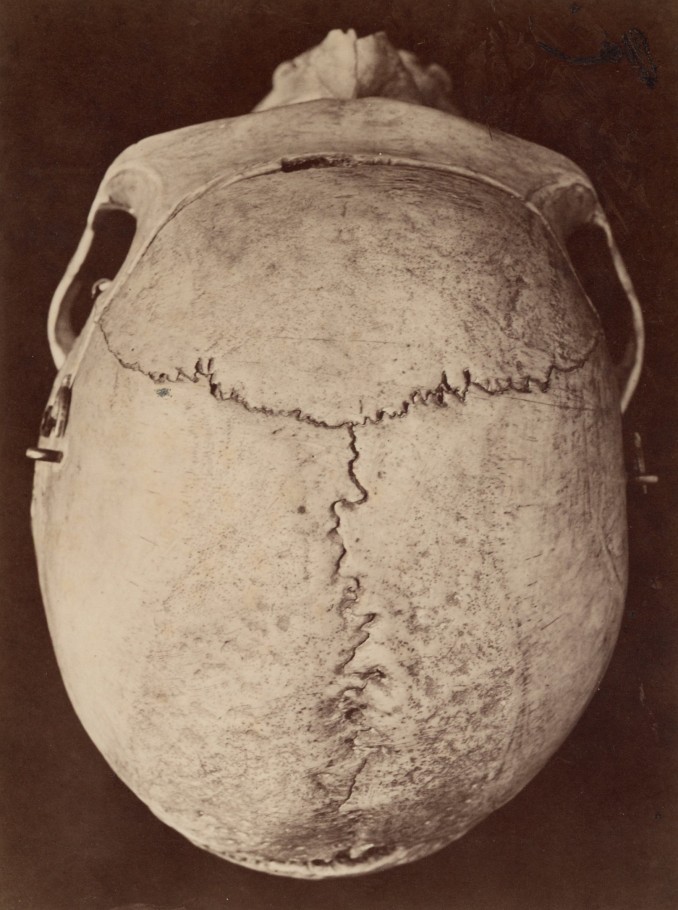 Human Skull, c. 1880