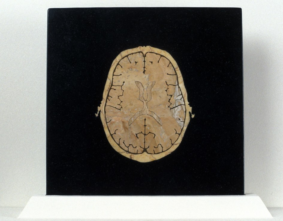 BRYAN CROCKETT, Inlay, 2002