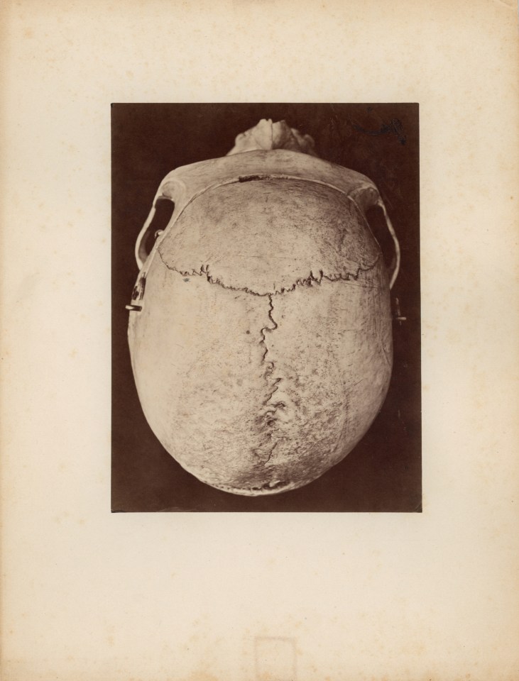 Human Skull, c. 1880